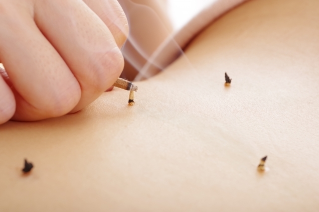 お腹の不調を優しく整え、身体の芯から回復を促す温かなお灸の風景