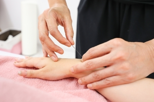 診に基づき、鍼の深さや角度を1ミリ単位で調整する一水堂の技術