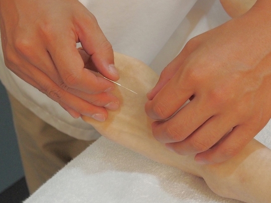 はり施術