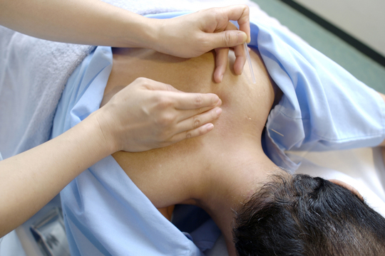 よく体をみて体質を見極めてはりをする事が重要です。