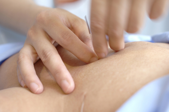 体全体を考えてツボを取る事が重要です。